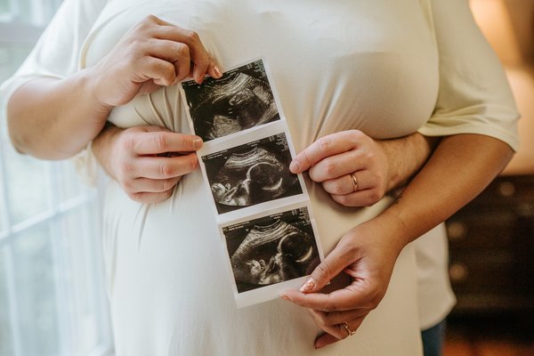 Maternity example