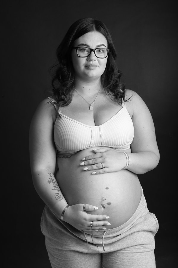 Maternity example