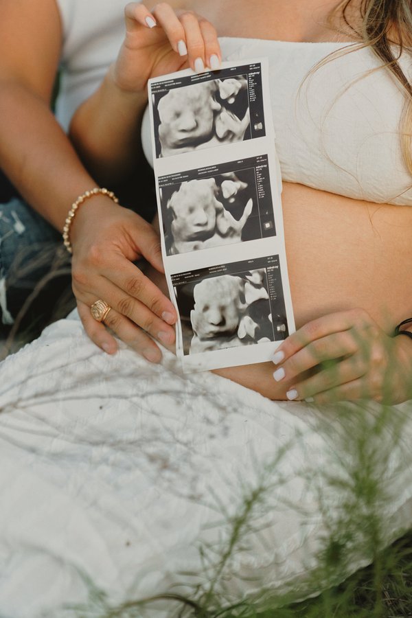 Maternity example