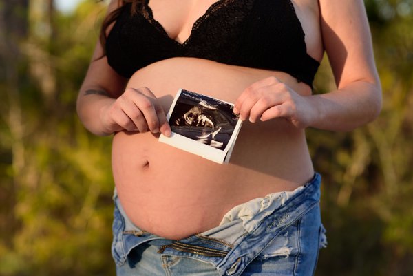 Maternity example