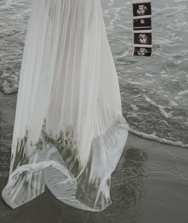 Maternity example
