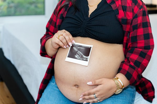 Maternity example