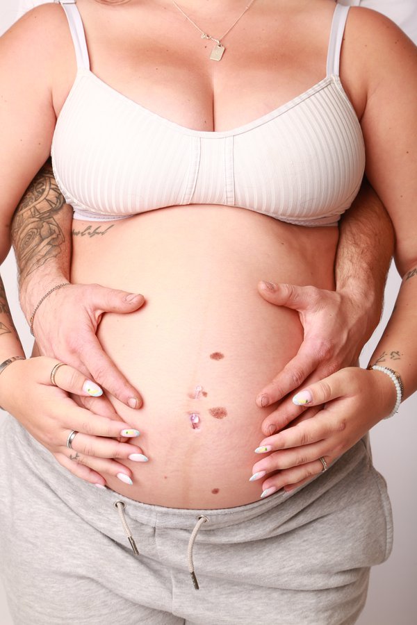 Maternity example