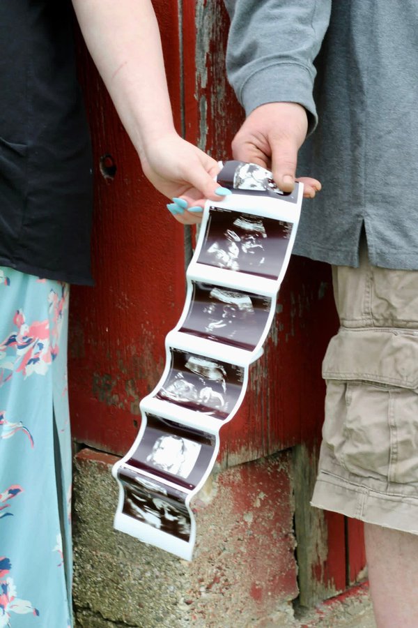 Maternity example