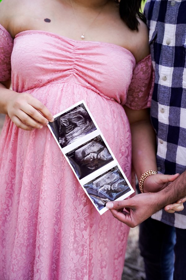 Maternity example