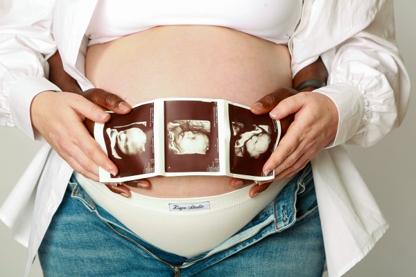 Maternity example