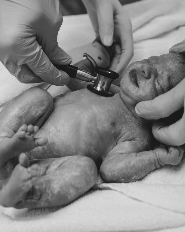 Newborn example