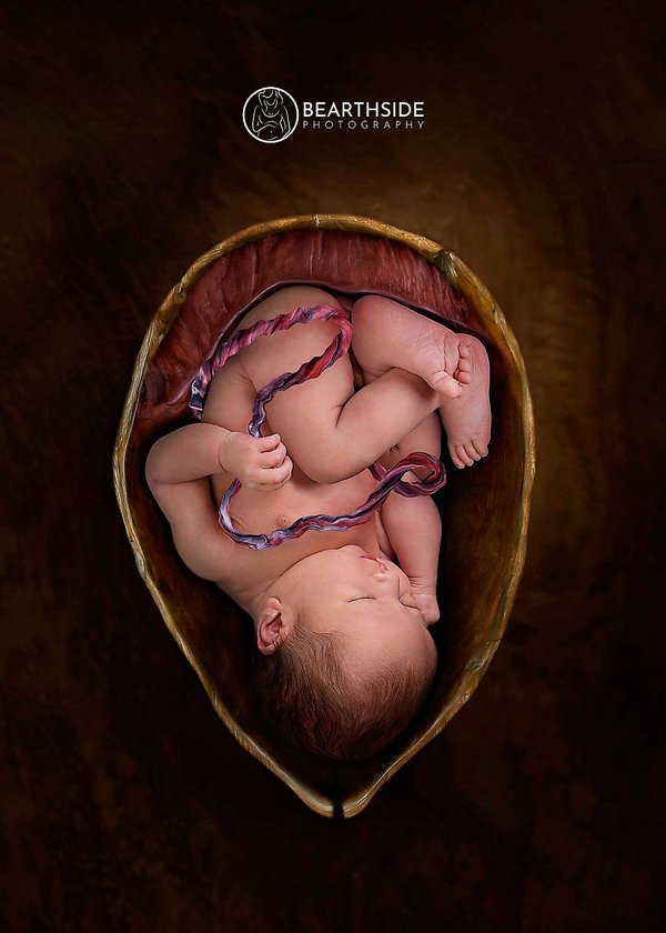 Newborn example