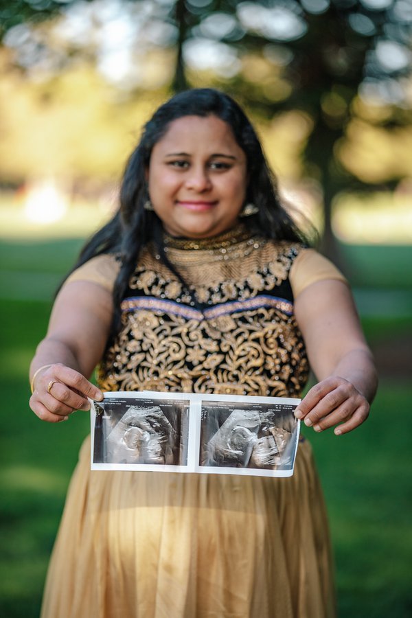 Maternity example