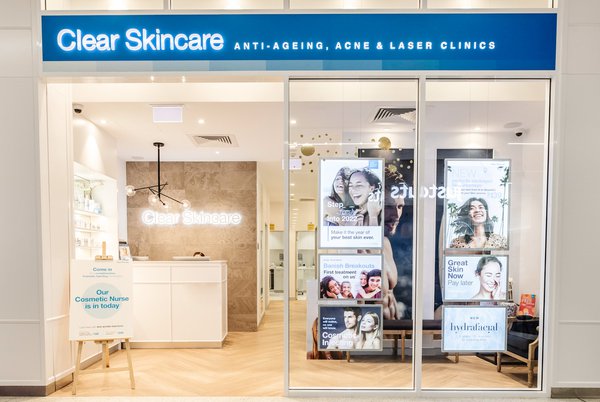 Commercial example